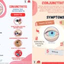 Conjunctivitis