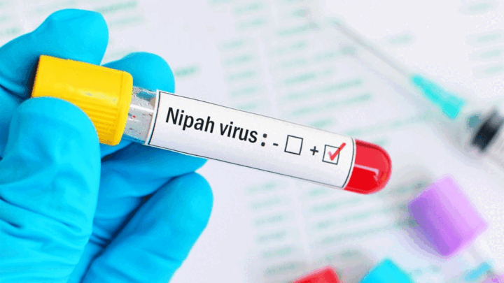 nipah