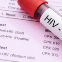 hiv