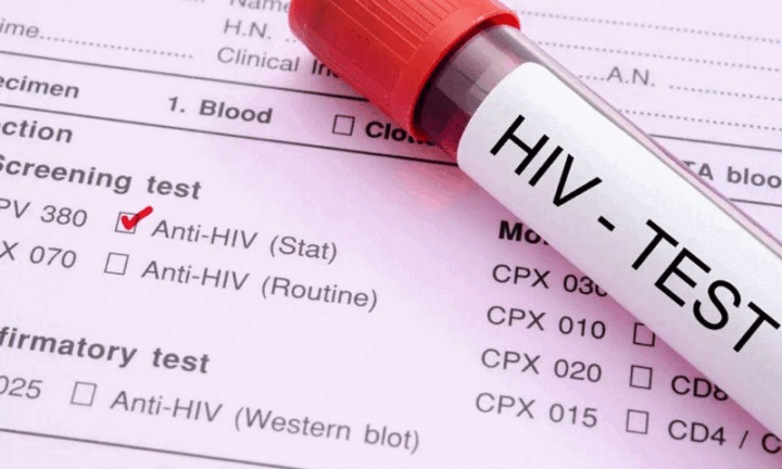 hiv